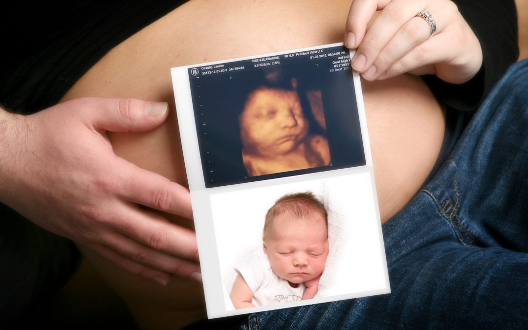 4D Ultrasound Image