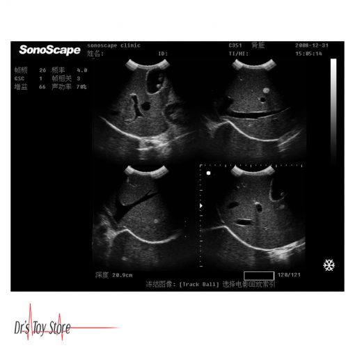 Sonoscape A6 Ultrasound System