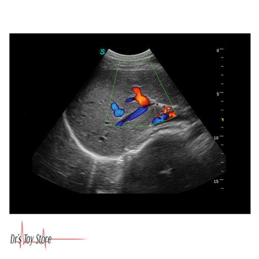 Sonoscape S2 Ultrasound System