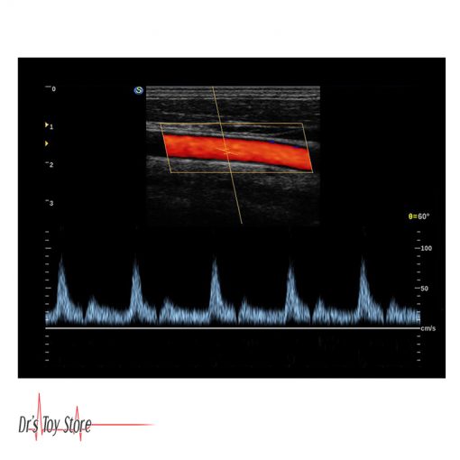 Sonoscape S2 Ultrasound System