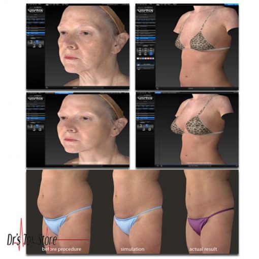 Canfield Vectra X3 3D Imaging System - Image 4