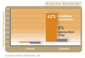 smartlipo-triplex-clinicaloutcomes