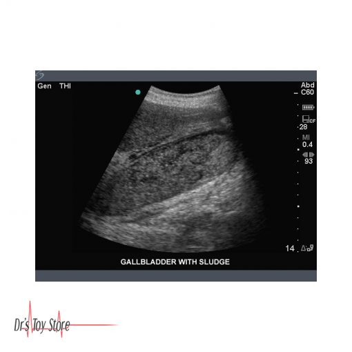 Sonosite Titan Ultrasound System