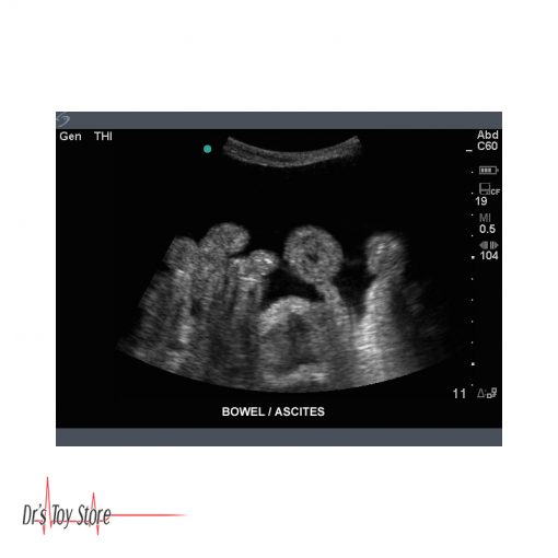 Sonosite Titan Ultrasound System