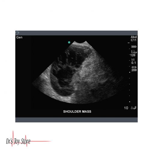 Sonosite Titan Ultrasound System