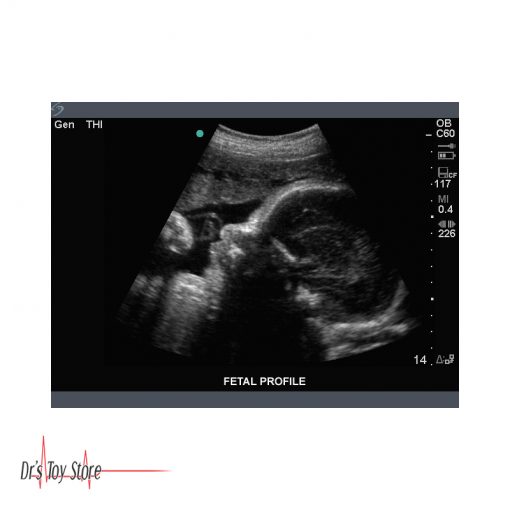 Sonosite Titan Ultrasound Machine