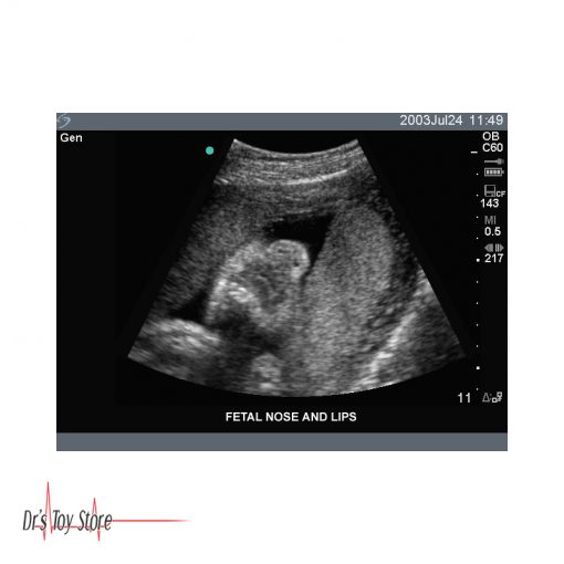 Sonosite Titan Ultrasound Machine