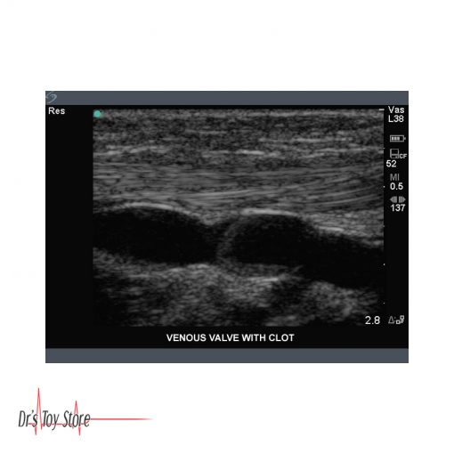 Sonosite Titan Ultrasound System - 2009 OB/GYN Setup - Image 8