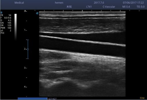 Sonoscape E1 Portable Ultrasound - Image 5