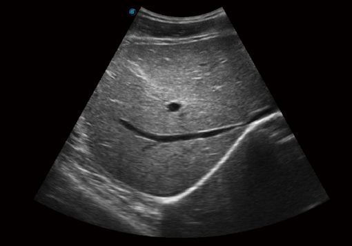 Sonoscape E1 EXP Portable Ultrasound - Image 4