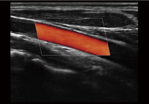 Sonoscape E1 EXP Portable Ultrasound - Image 5