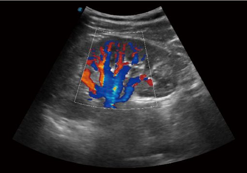 Sonoscape E1 EXP Portable Ultrasound - Image 6
