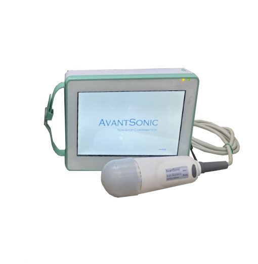 AvantSonic Z3 Bladder Scanner