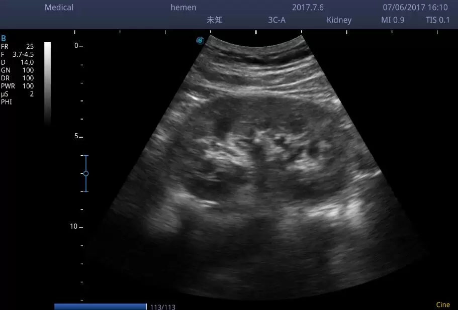 Sonoscape E1 Portable Ultrasound - Image 6