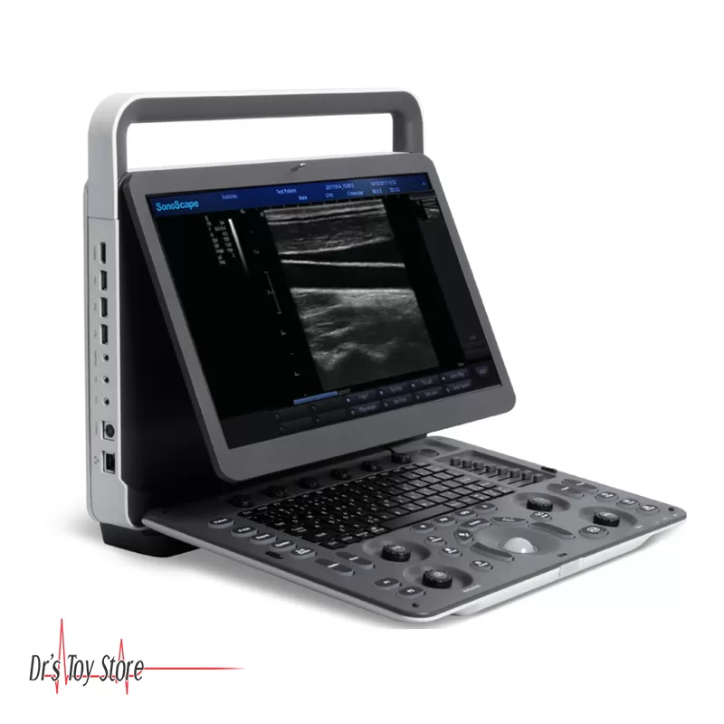 Sonoscape E1 Portable Ultrasound - Image 4