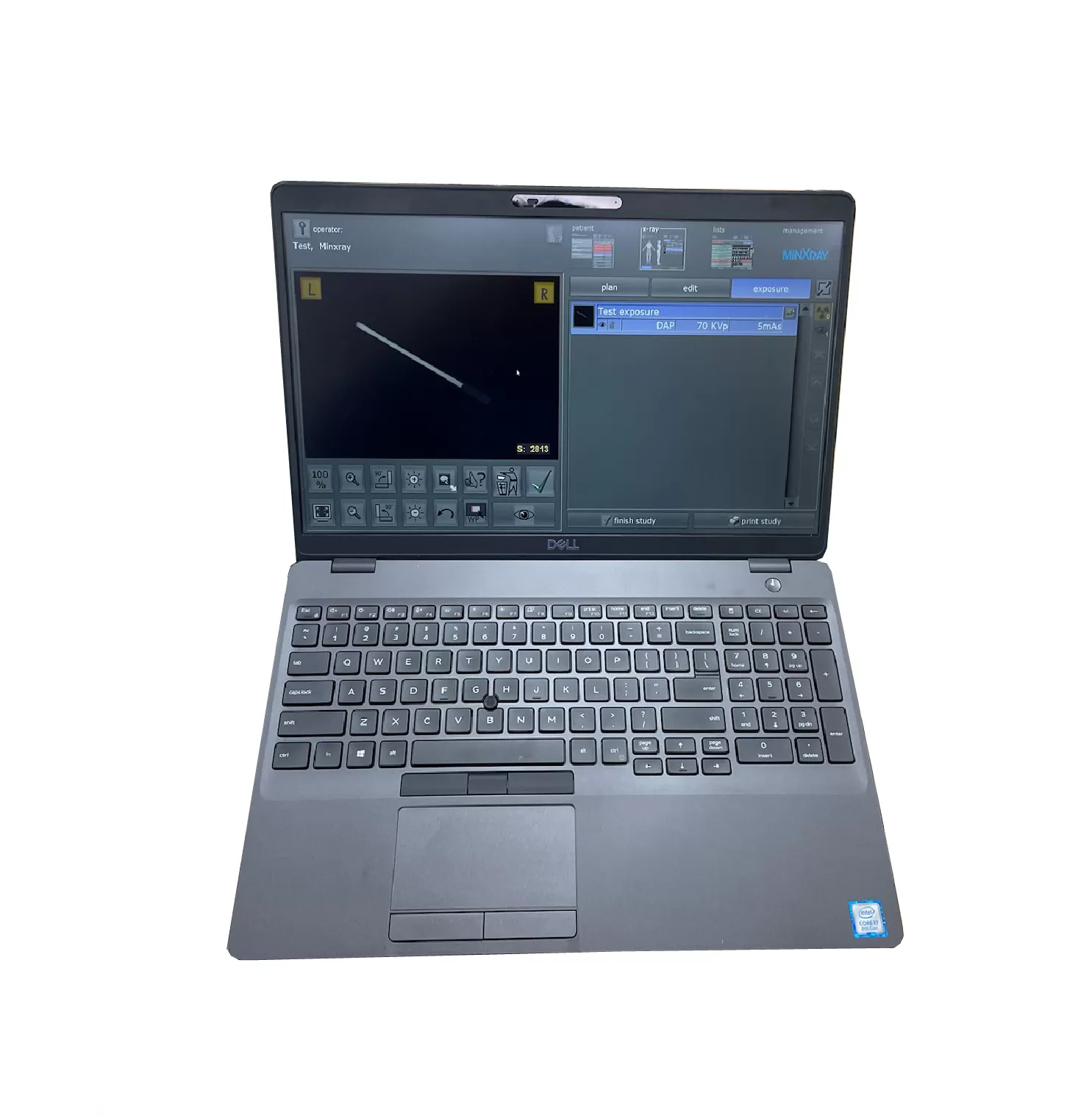 MinXray HF100H+ Portable X-Ray Machine - Image 6